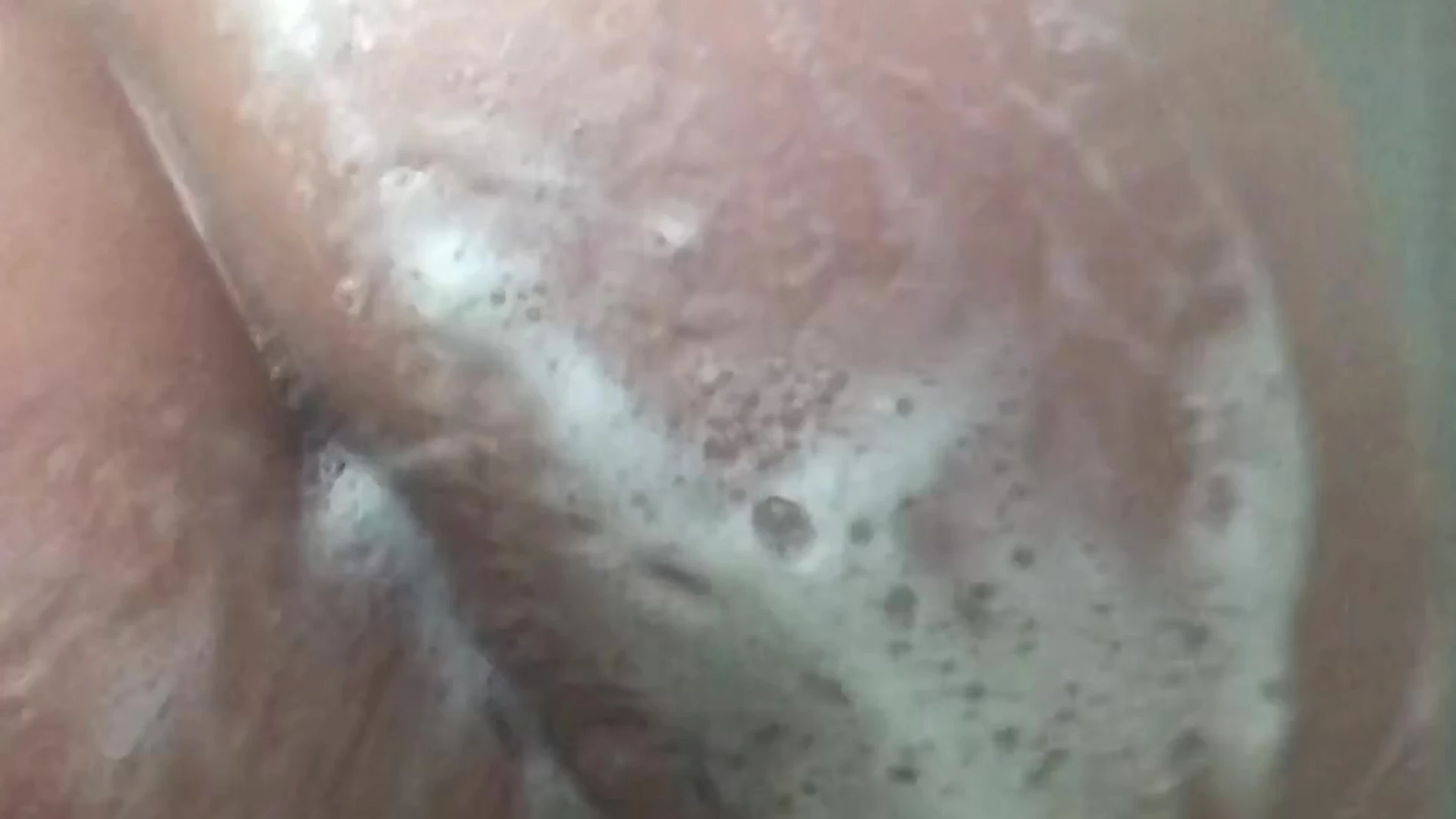 Epic candyassed Lolaxmina Leak