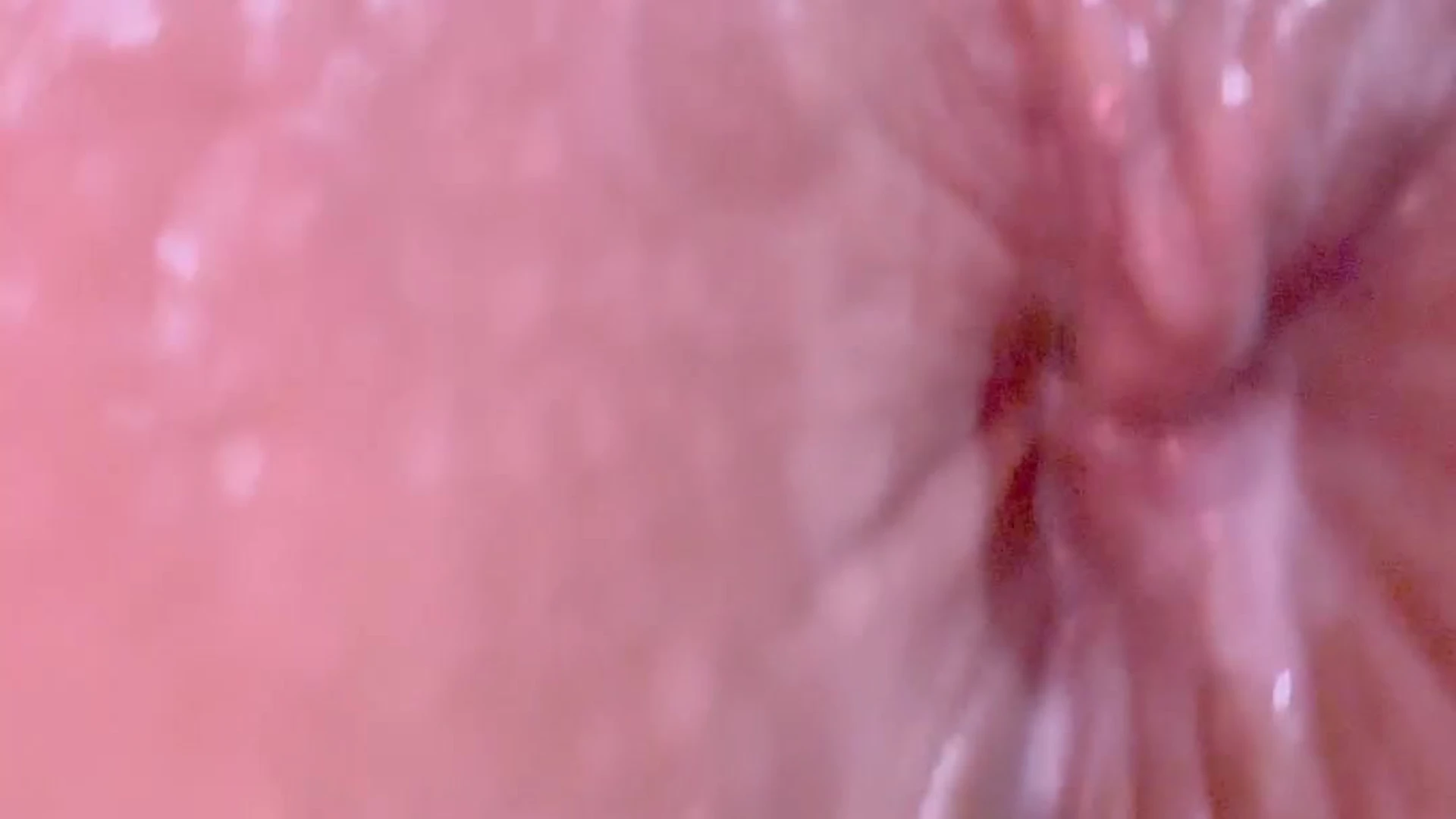 ball Yinyleon Nudes FullVID
